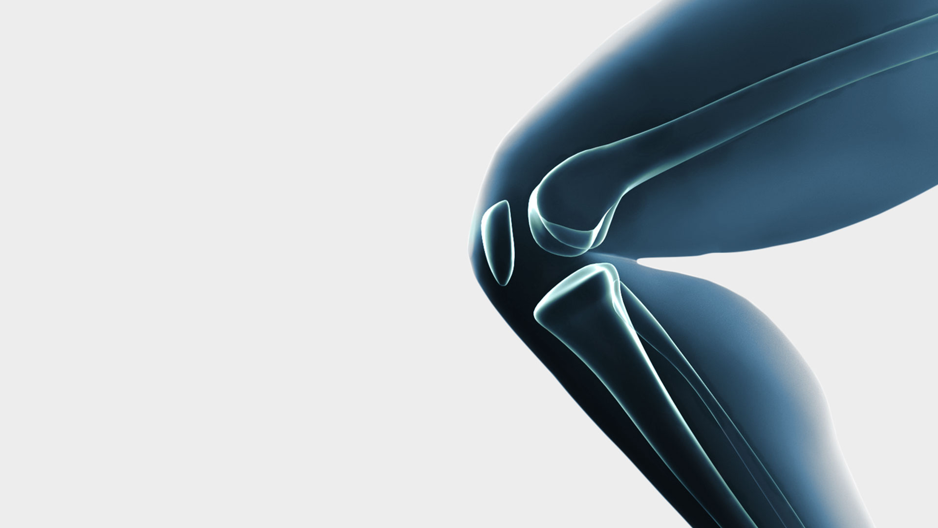 Moderner und individueller Kniegelenkersatz bei Arthrose